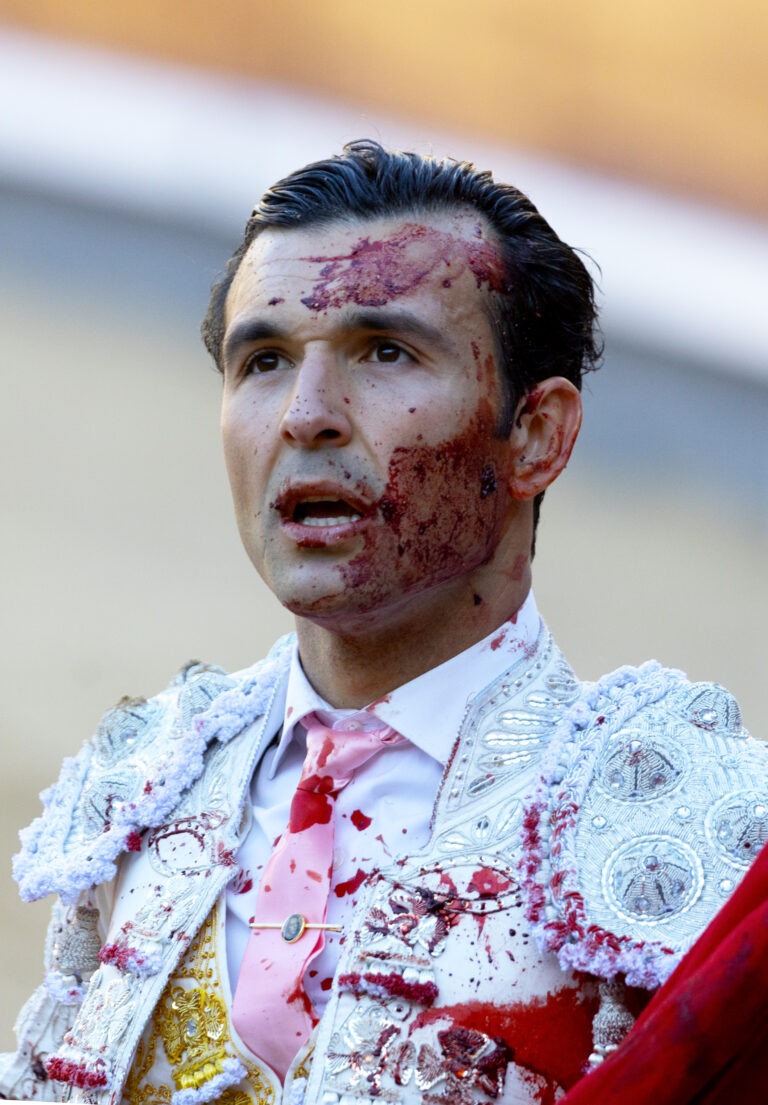 CRISTIÁN PÉREZ PAGA CON SANGRE UNA DIGNA CONFIRMACION